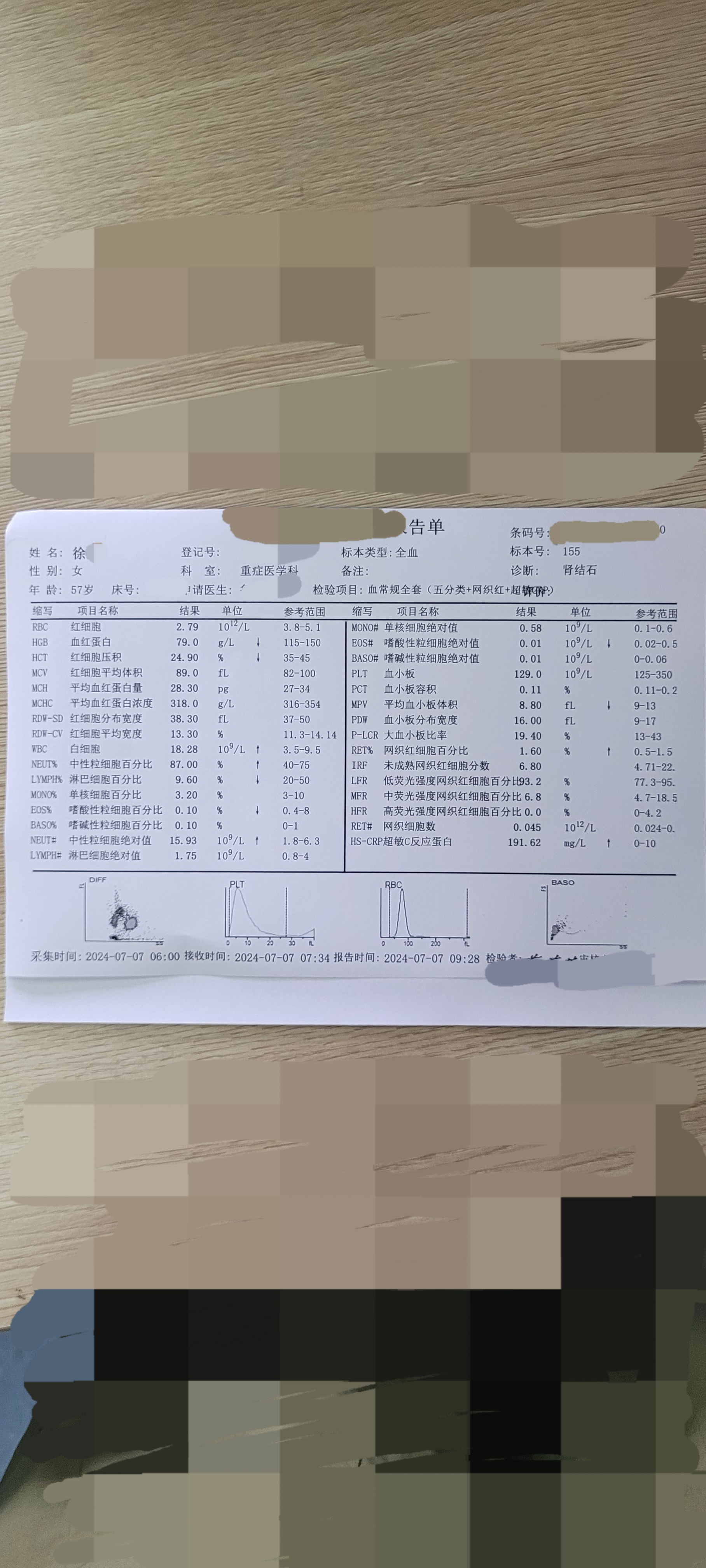 白细胞计数(1061/l):18.282.血小板(1061/l):1293.